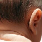 Los expertos consideran que siempre se debe esperar a que el niño exprese ese complejo