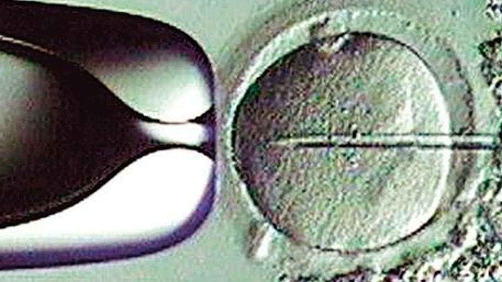 Un solo embrión más barato y eficaz en fecundación in vitro