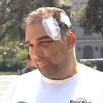 José Bravo, el turista herido