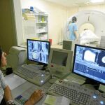 La incidencia del cáncer de tiroides aumenta en el noroeste de España