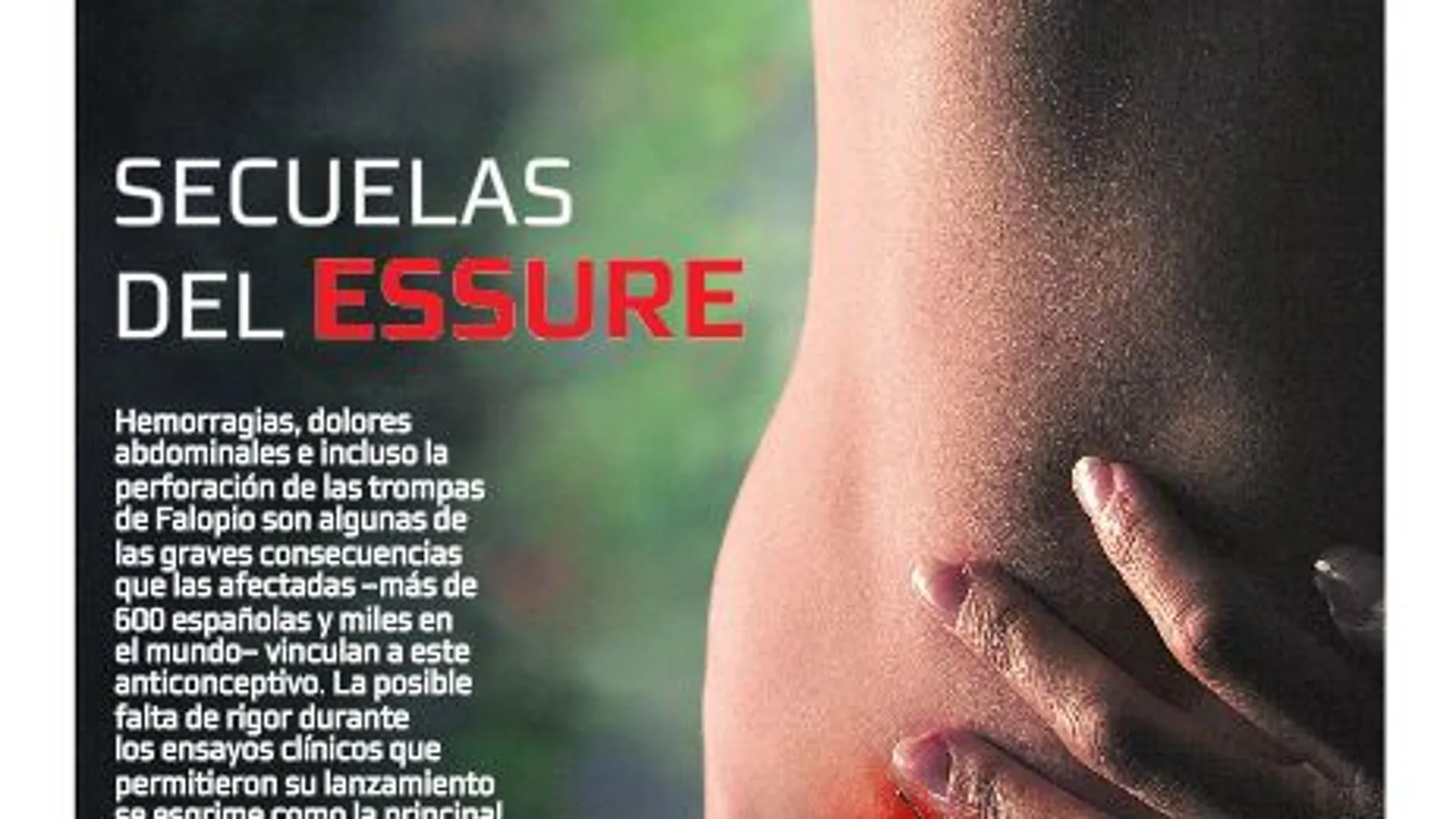 Secuelas del Essure