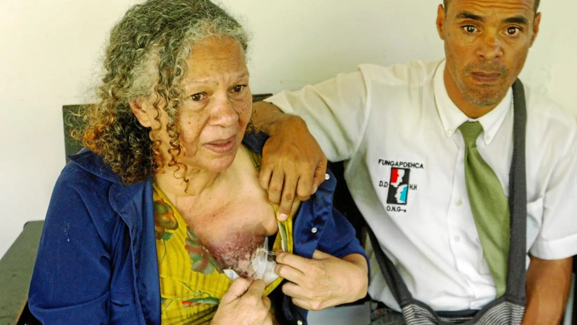 Un seno carcomido retrata la salud de Venezuela