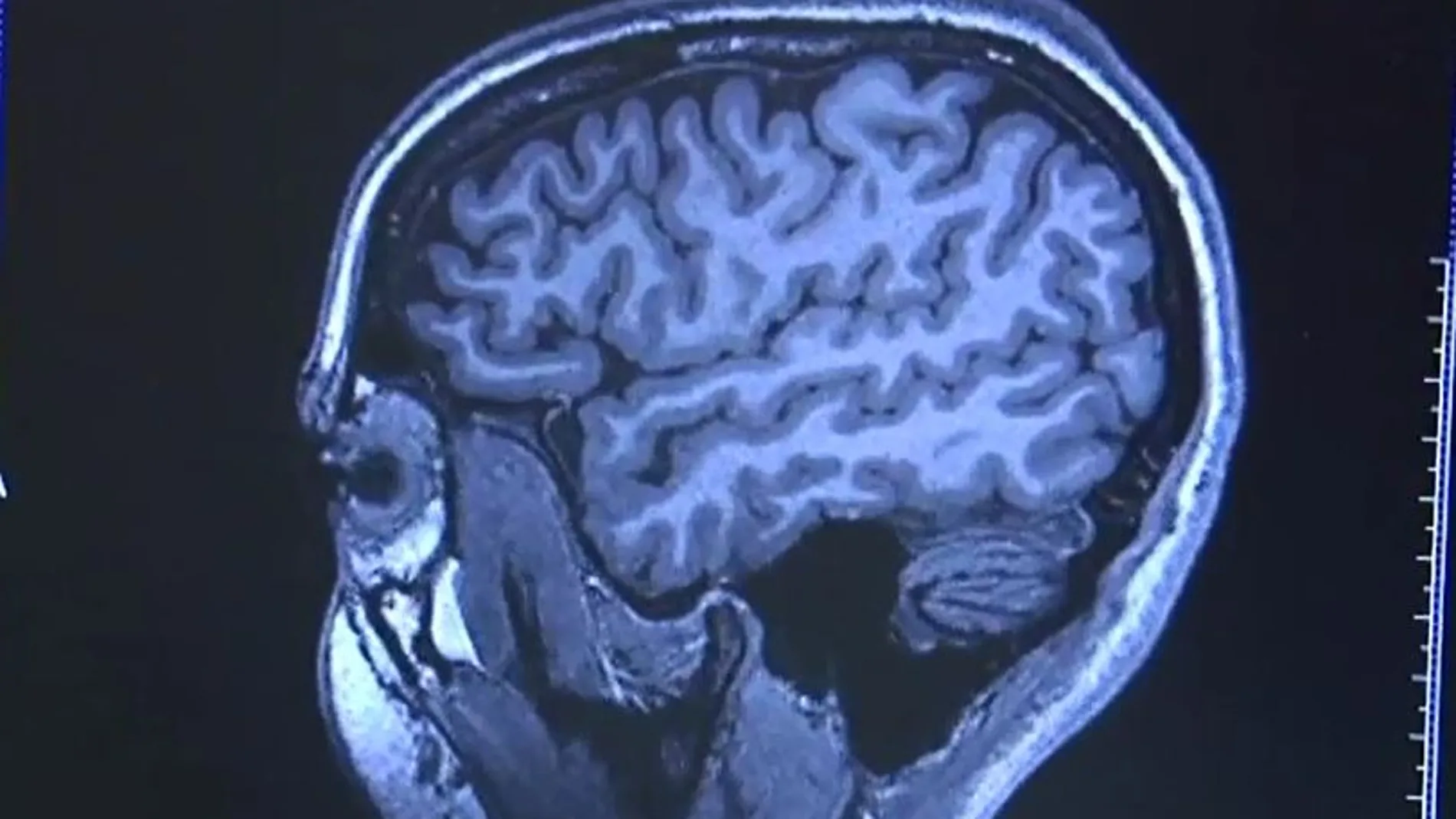 ¿Cómo funciona el cerebro de un maltratador?