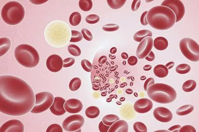 ¿Se puede detectar el cáncer a partir de una muestra de sangre?