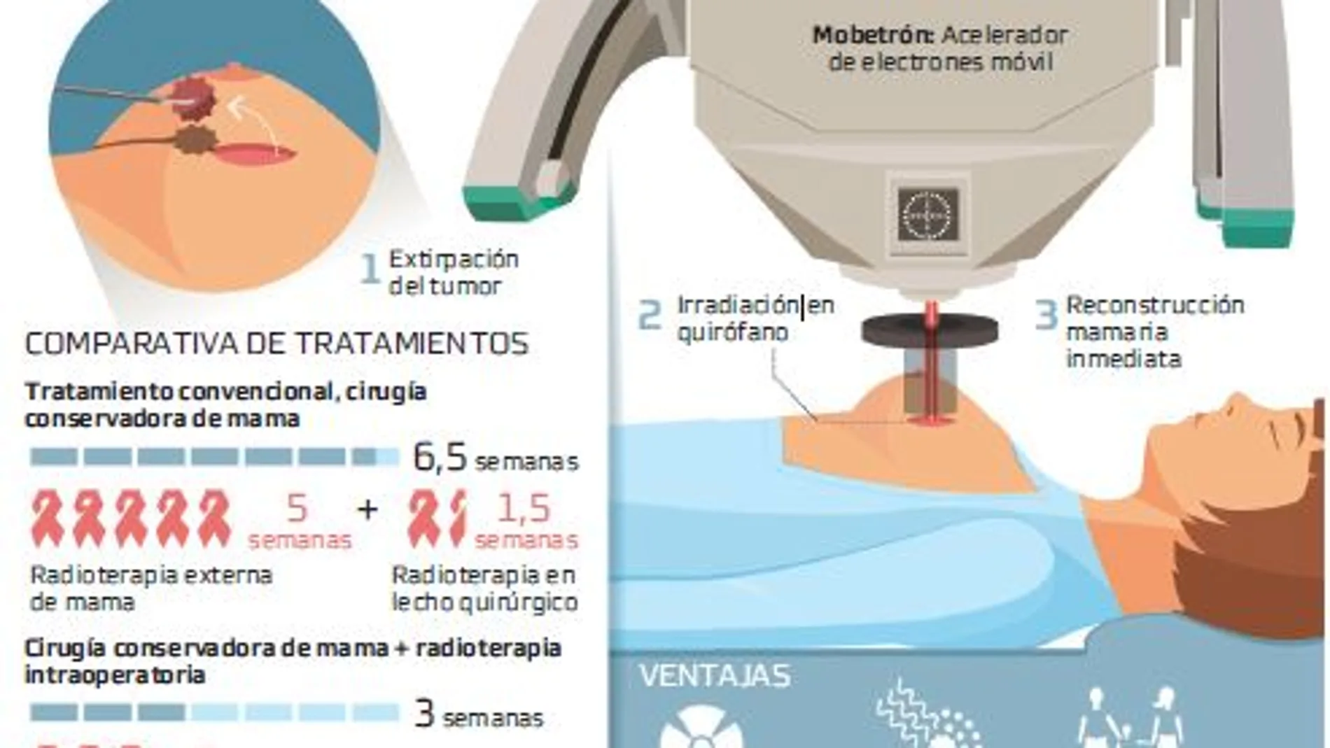 Radioterapia intraoperatoria, aliada del cáncer de mama