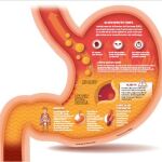 Gastroprotectores: Un abuso continuado atrofia al estómago
