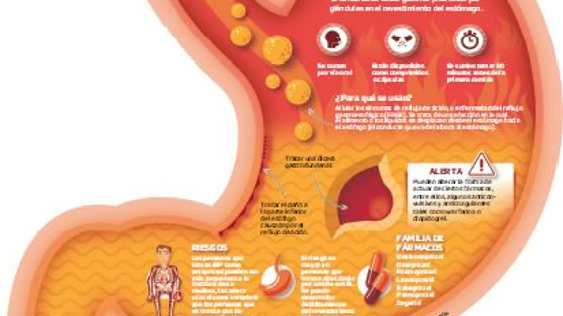 Gastroprotectores: Un abuso continuado atrofia al estómago