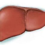 Una de cada doce personas tiene hepatitis crónica