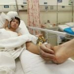 Imagen de Zhou en la cama, con la mano implantada en su tobillo