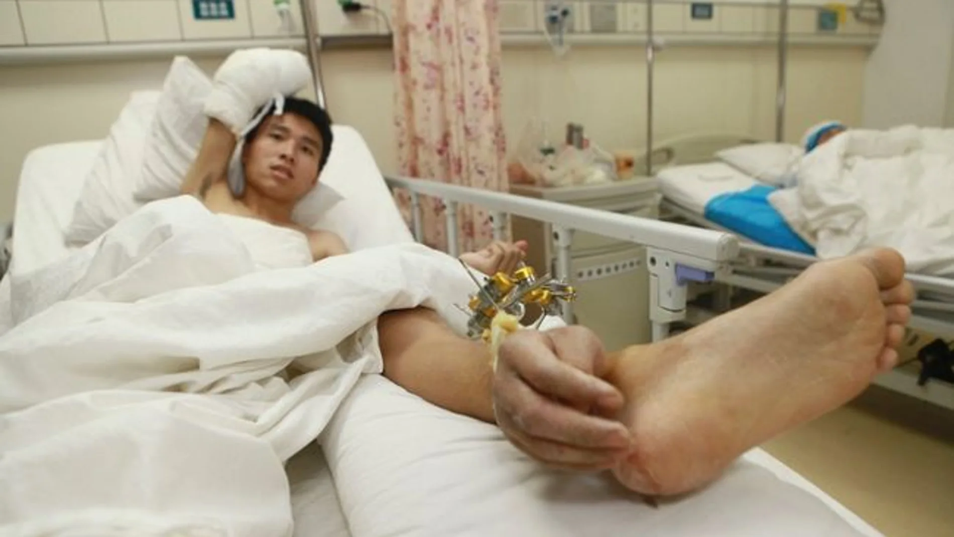 Imagen de Zhou en la cama, con la mano implantada en su tobillo