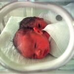 Según la Organización Mundial de la Salud, unos 15 millones de bebés nacen prematuramente cada año.