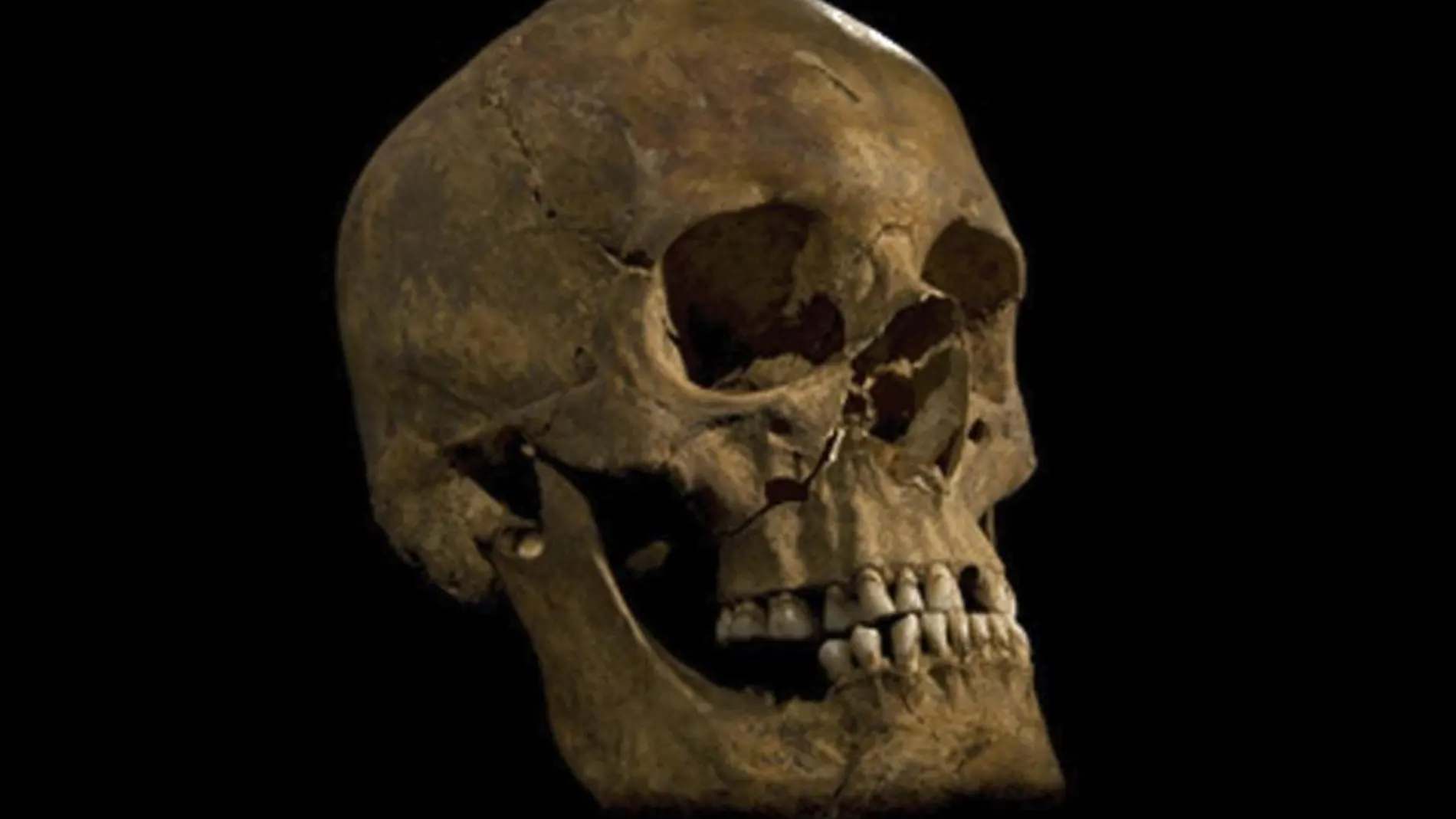 Imagen distribuida por la Universidad de Leicester que muestra una calavera que tras una serie de investigaciones científicas, se cree que pertenece al Rey Ricardo III.