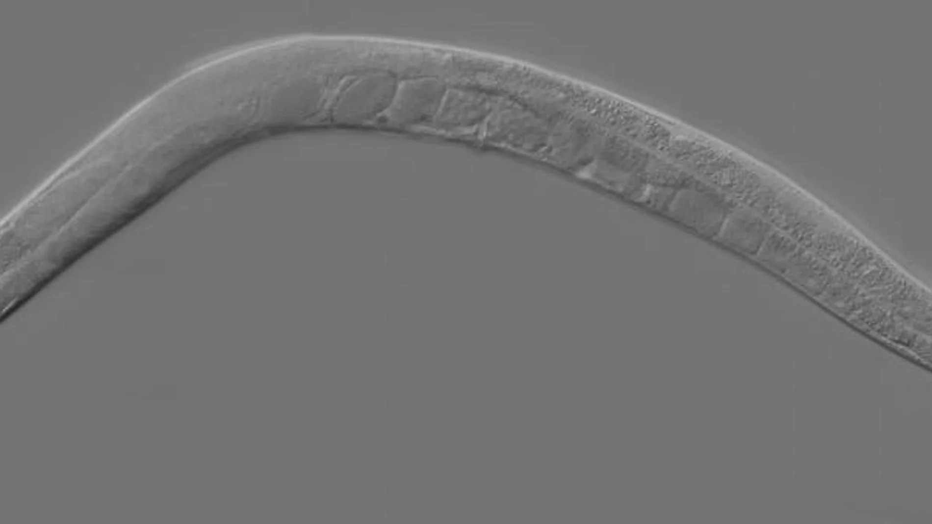 Un ejemplar del gusano Caenorhabditis elegans