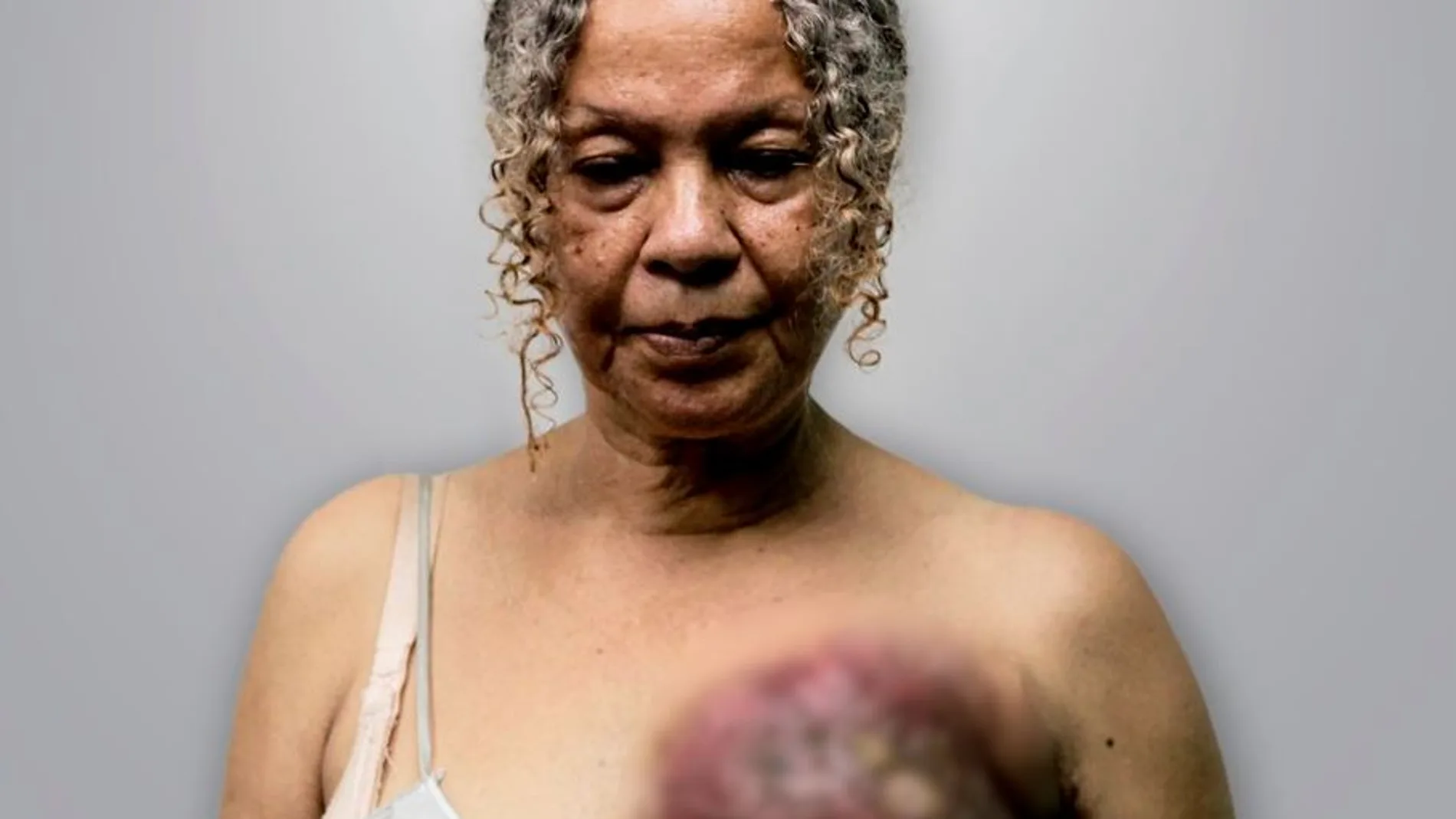 Elizabeth Salazar, de 63 años, fue diagnosticada con cáncer de mama hace ocho meses. Foto: Amnistía Internacional.