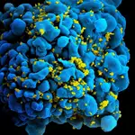 Una célula infectada con VIH