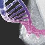 Entre el 5-10% de los tumores es hereditario