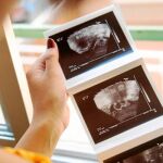 ANÁLISIS: Diez días para derivar a la mujer