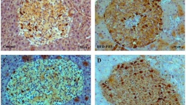 El tratamiento disminuyó la apoptosis en los islotes pancreáticos, donde se alojan las células productoras de insulina