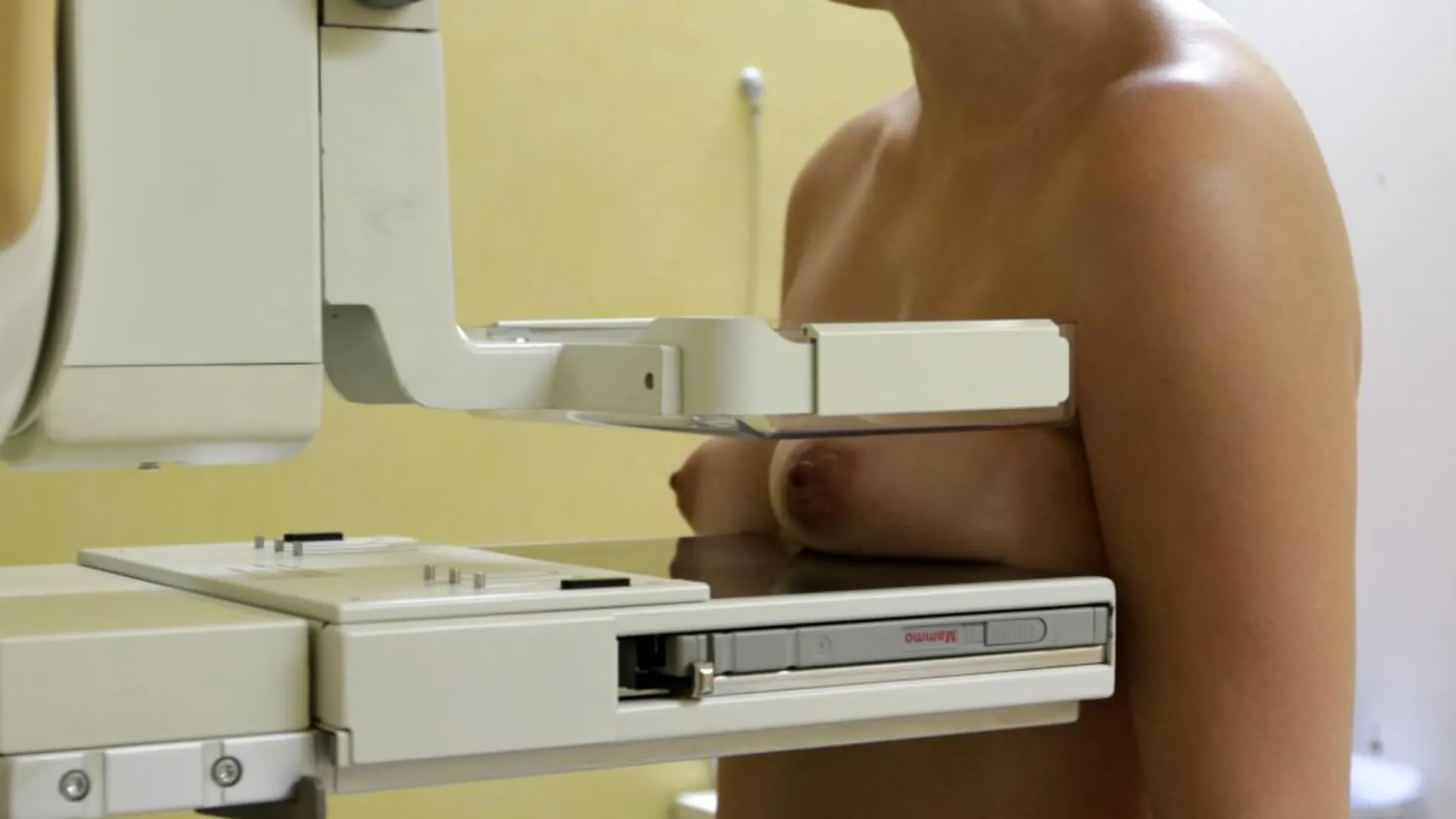 Mamografía tradicional a una paciente, en una imagen de archivo