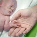 Anualmente nacen en el mundo 15 millones de prematuros