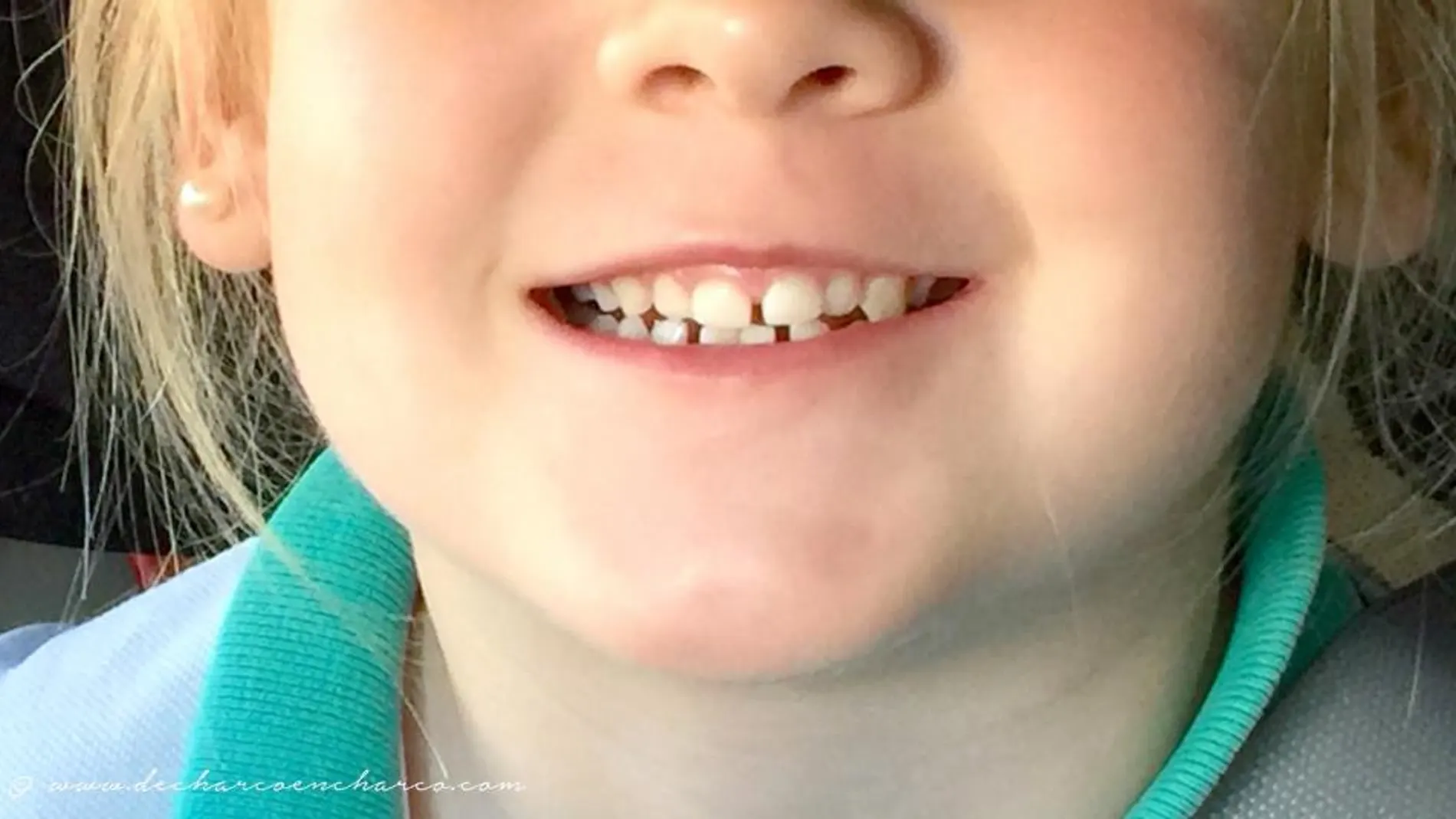 Los dientes de leche: más bocadillos y menos bollos