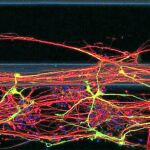Neuronas 3-D para combatir el párkinson