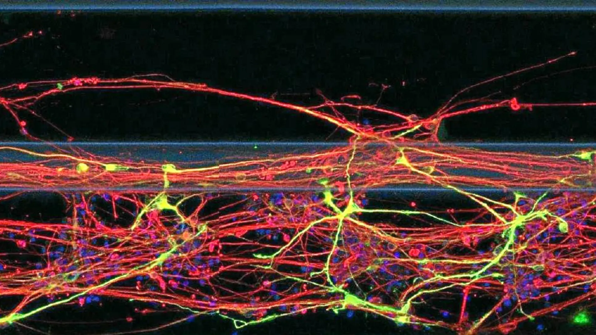 Neuronas 3-D para combatir el párkinson