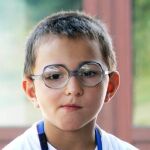 La ambliopía afecta al cuatro por ciento de la población humana