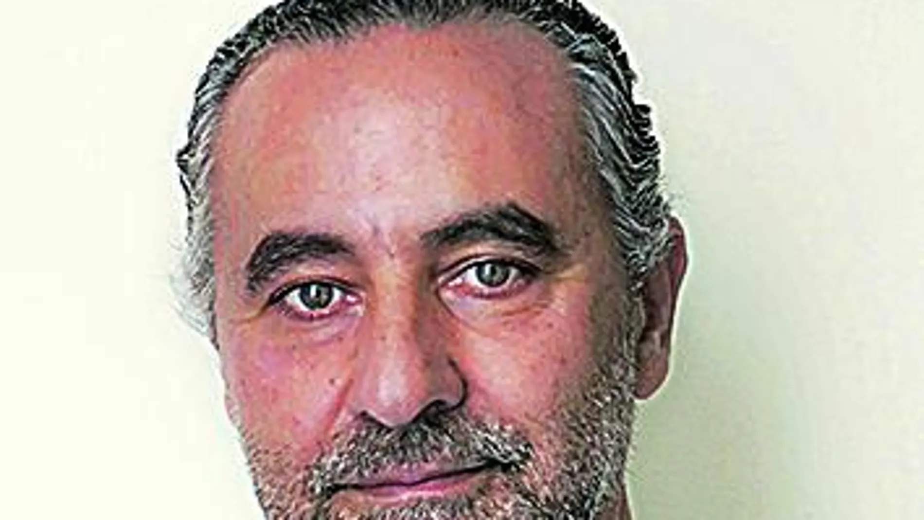 Dr. J.L. Martín del Yerro/ Jefe del Servicio de Cirugía Plástica Reparadora y Estética del Hospital Universitario Quirón Madrid