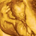 La Generalitat entrega ecografías en tres dimensiones de gestantes para disuadir a las mujeres de que interrumpan su embarazo