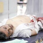Un hombre herido ayer en Raqa por los bombardeos de la coalición internacional, una imagen difundida por una web del Estado Islámico