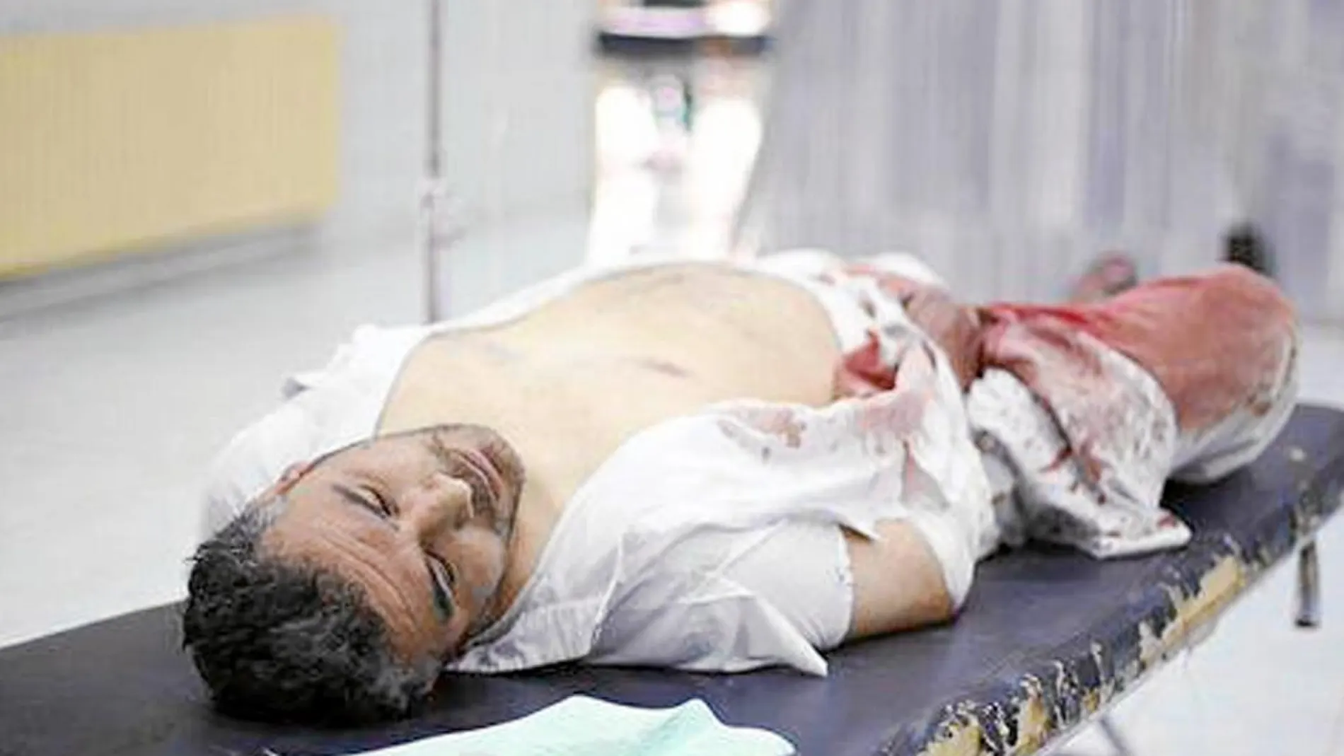 Un hombre herido ayer en Raqa por los bombardeos de la coalición internacional, una imagen difundida por una web del Estado Islámico