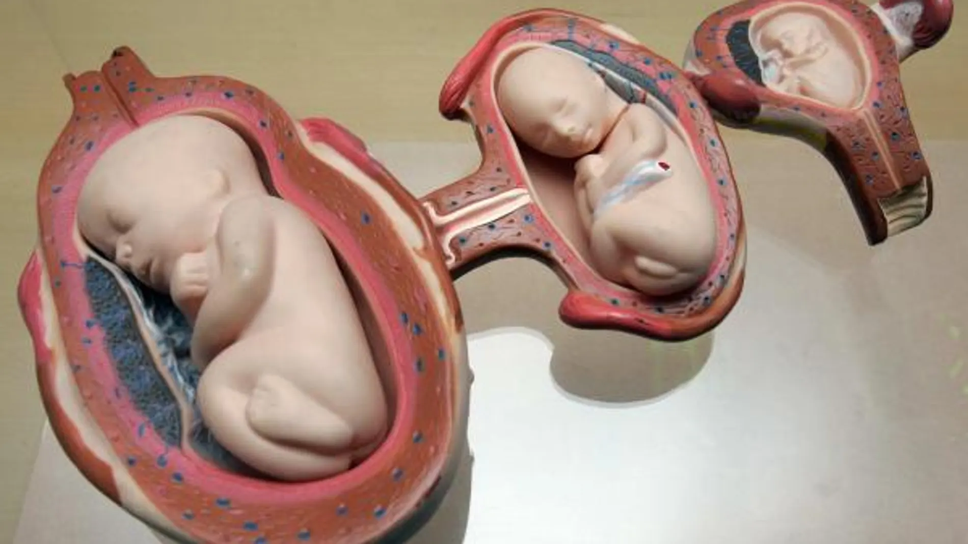 Sanidad eliminará el estado civil de la estadística del aborto