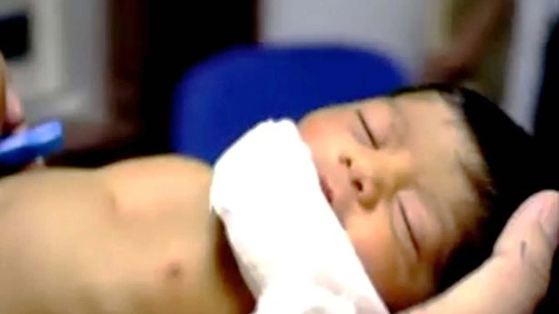 Imagen del bebé a su llegada a la unidad de cuidados intensivos del centro hospitalario