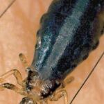 Piojo hembra sobre la piel