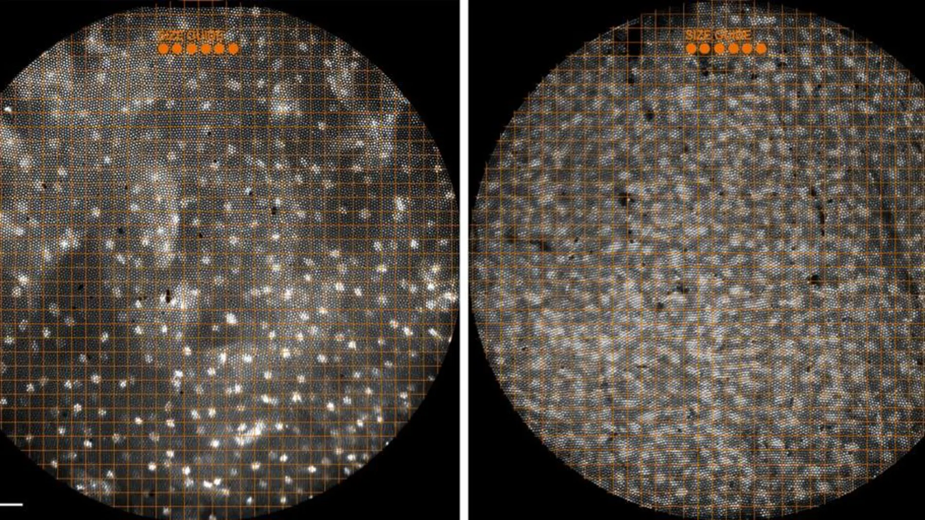 Las biopsias líquidas revelan más mutaciones en tumores que las de tejidos