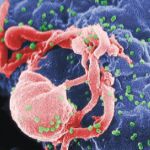 El virus del sida