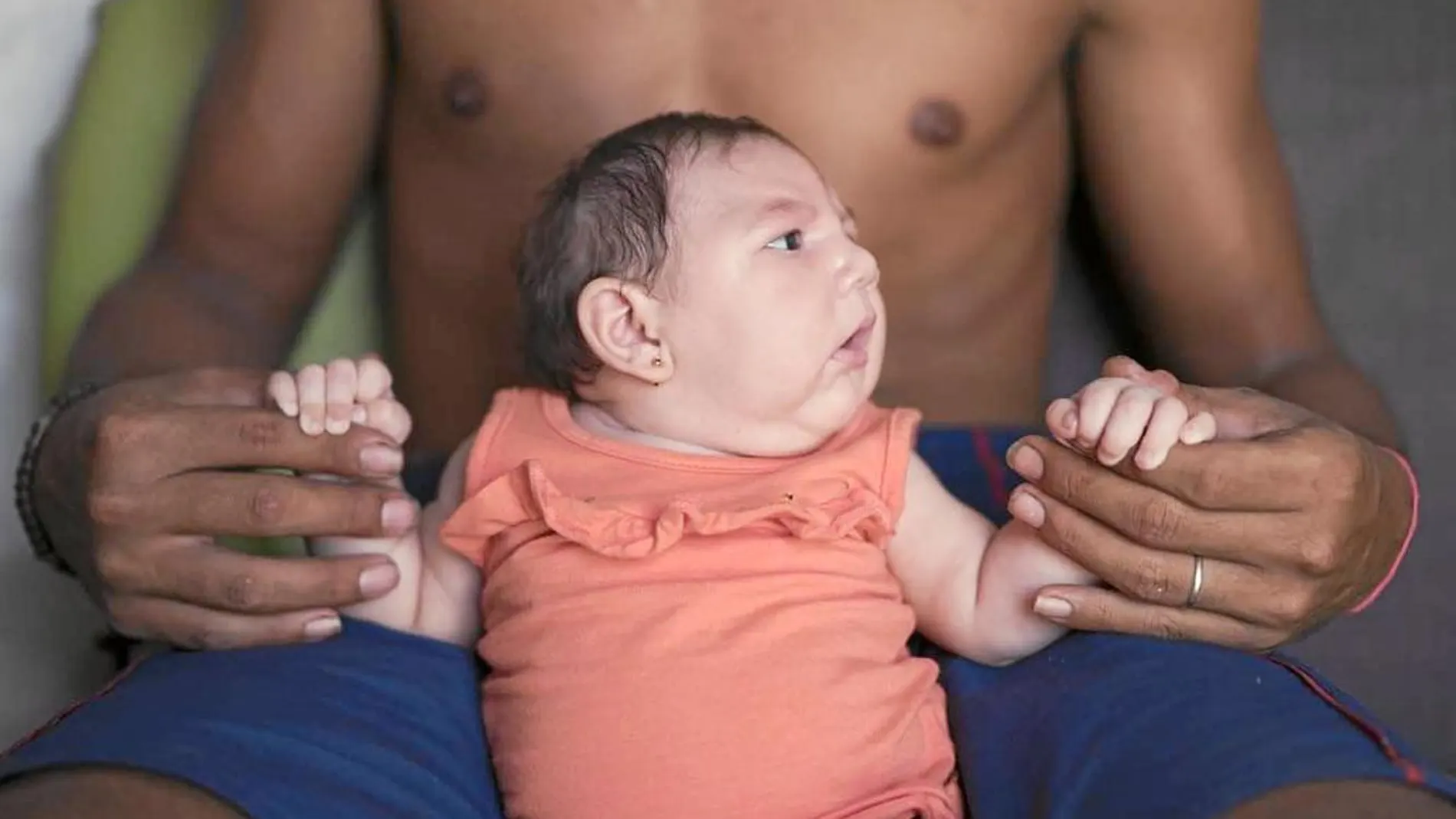 Un bebé nacido con microcefalia es sostenido por su padre, en Brasil
