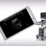 Una «app» permite a las embarazadas ver a su futuro bebé en 3D, 4D y en alta definición