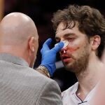 Pau Gasol, atendido de un herida en un partido de la NBA