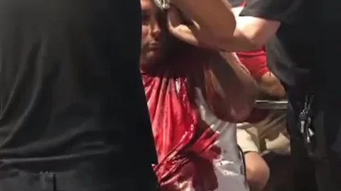 El hombre fue atendido por vigilantes de seguridad