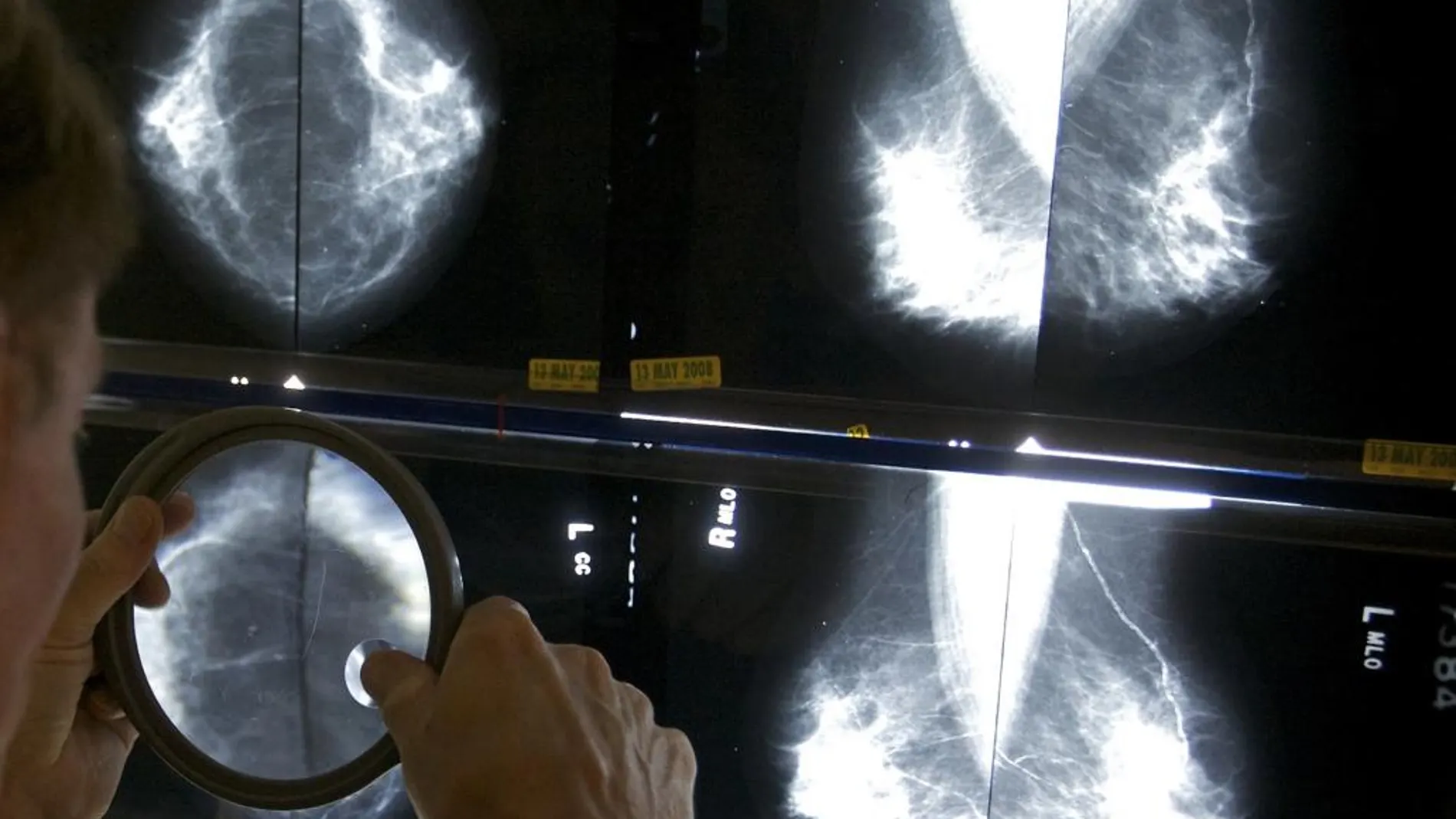 Una nueva tecnología permite a las mujeres controlar la presión sobre la mama durante las mamografías