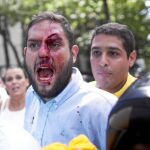Juan Requesens, la cara partida de la oposición