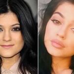 El antes y el después de Kylie Jenner