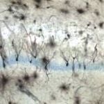 Los daños en neuronas granulares asociados al Alzheimer son reversibles