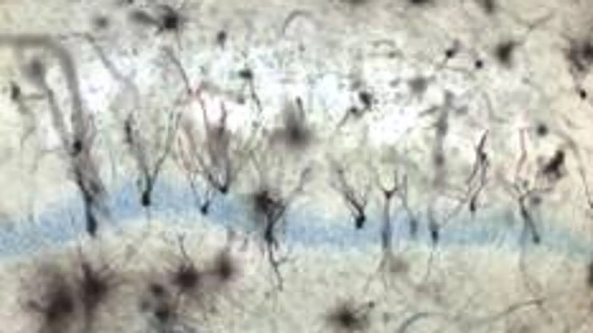 Los daños en neuronas granulares asociados al Alzheimer son reversibles