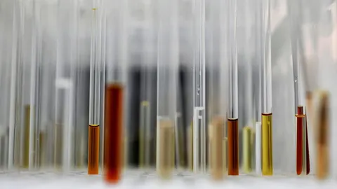 Tubos de ensayo para análisis en el centro de investigación del cáncer en Sutton, Gran Bretaña