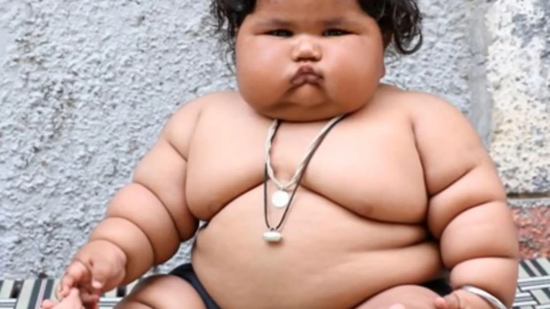 El bebé de ocho meses, Chahat Kumar, ya pesa 17 kilos
