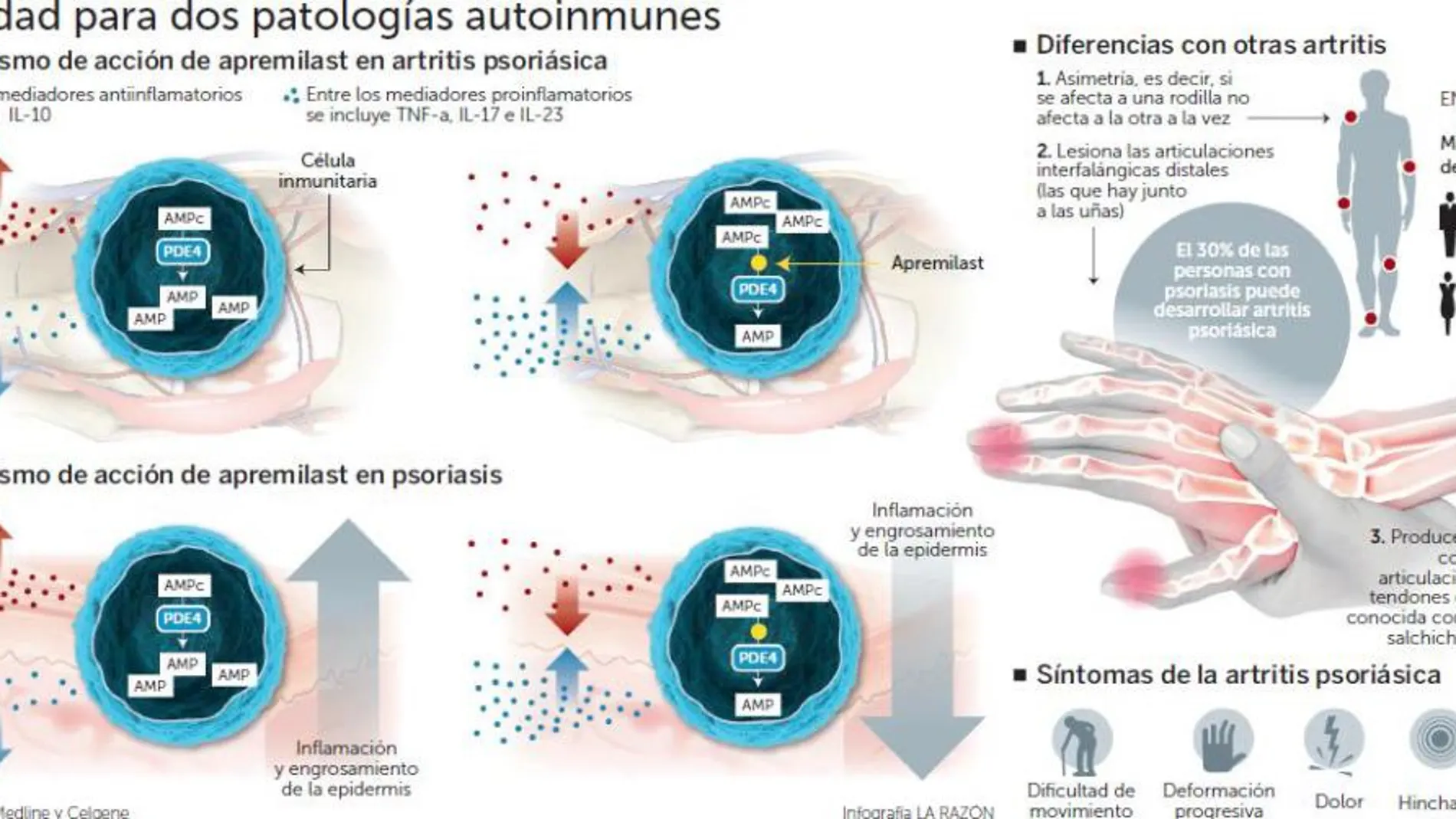 Novedad para dos patologías autoinmunes