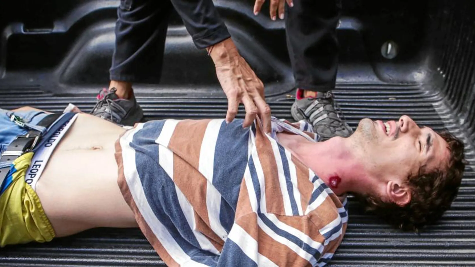Un manifestante herido en los disturbios del domingo